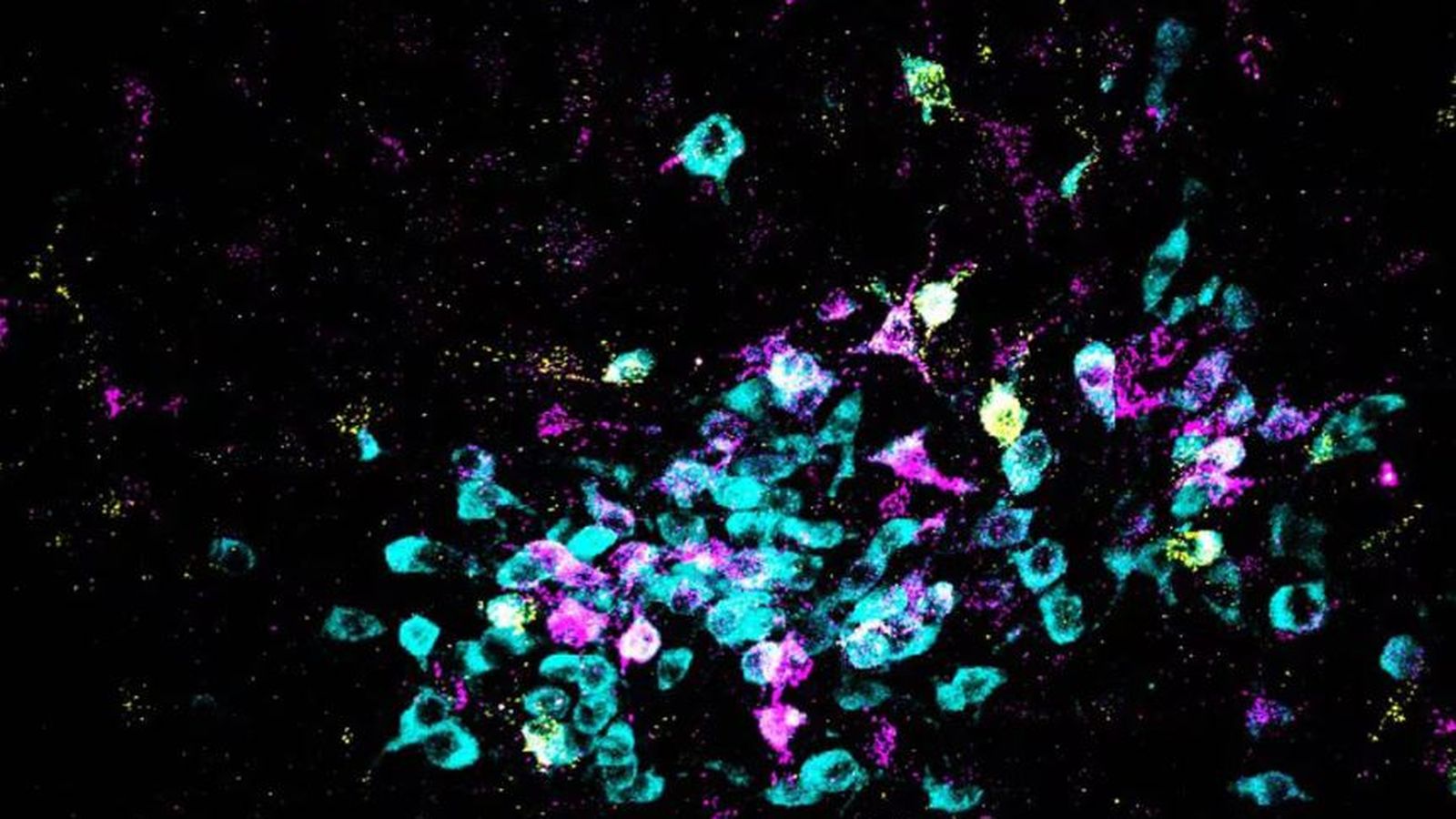 Les neurones apareixen en cian i els traçadors retrògrads, en groc i magenta