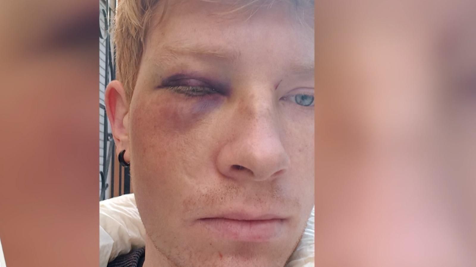 Agressió homòfoba a València: "Vaig amb por pel carrer"