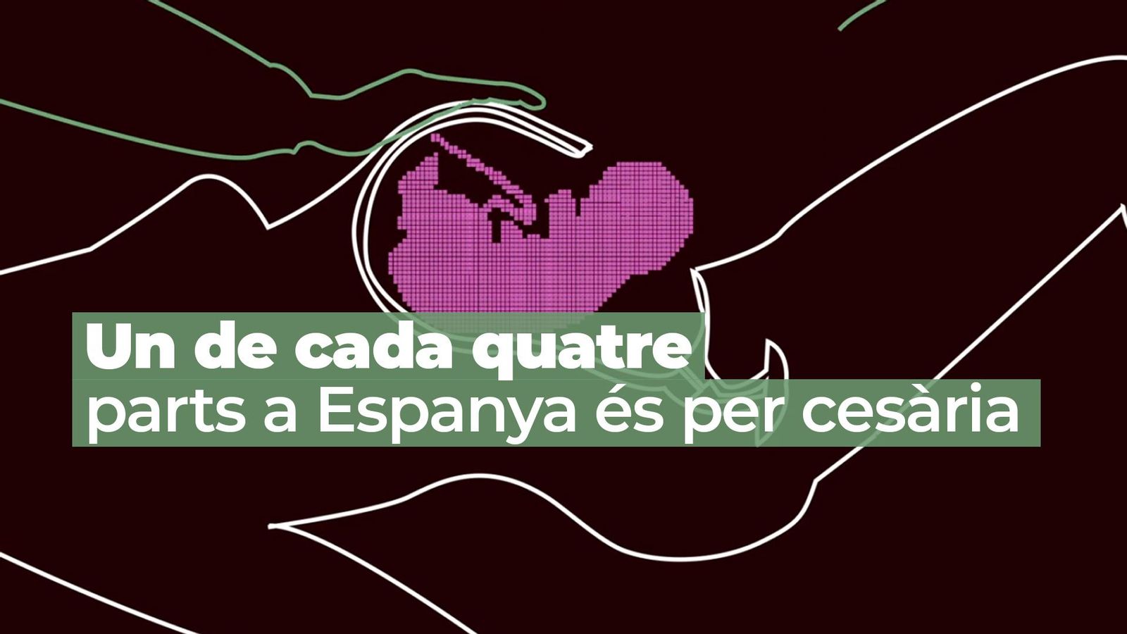 Violència obstètrica: les ferides invisibles del part