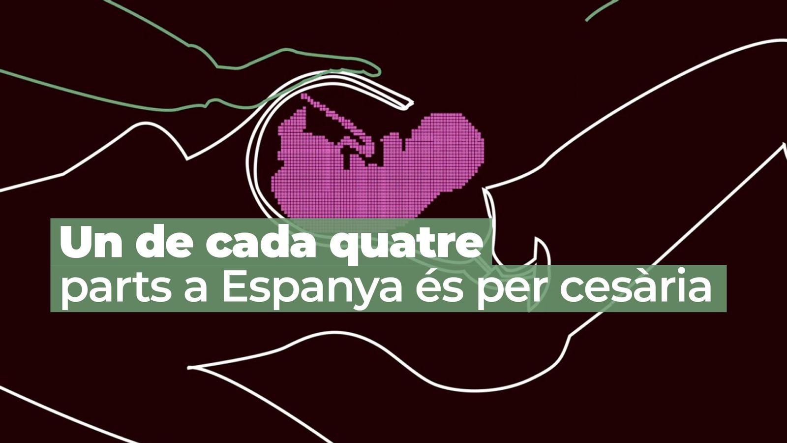 Violència obstètrica: les ferides invisibles del part