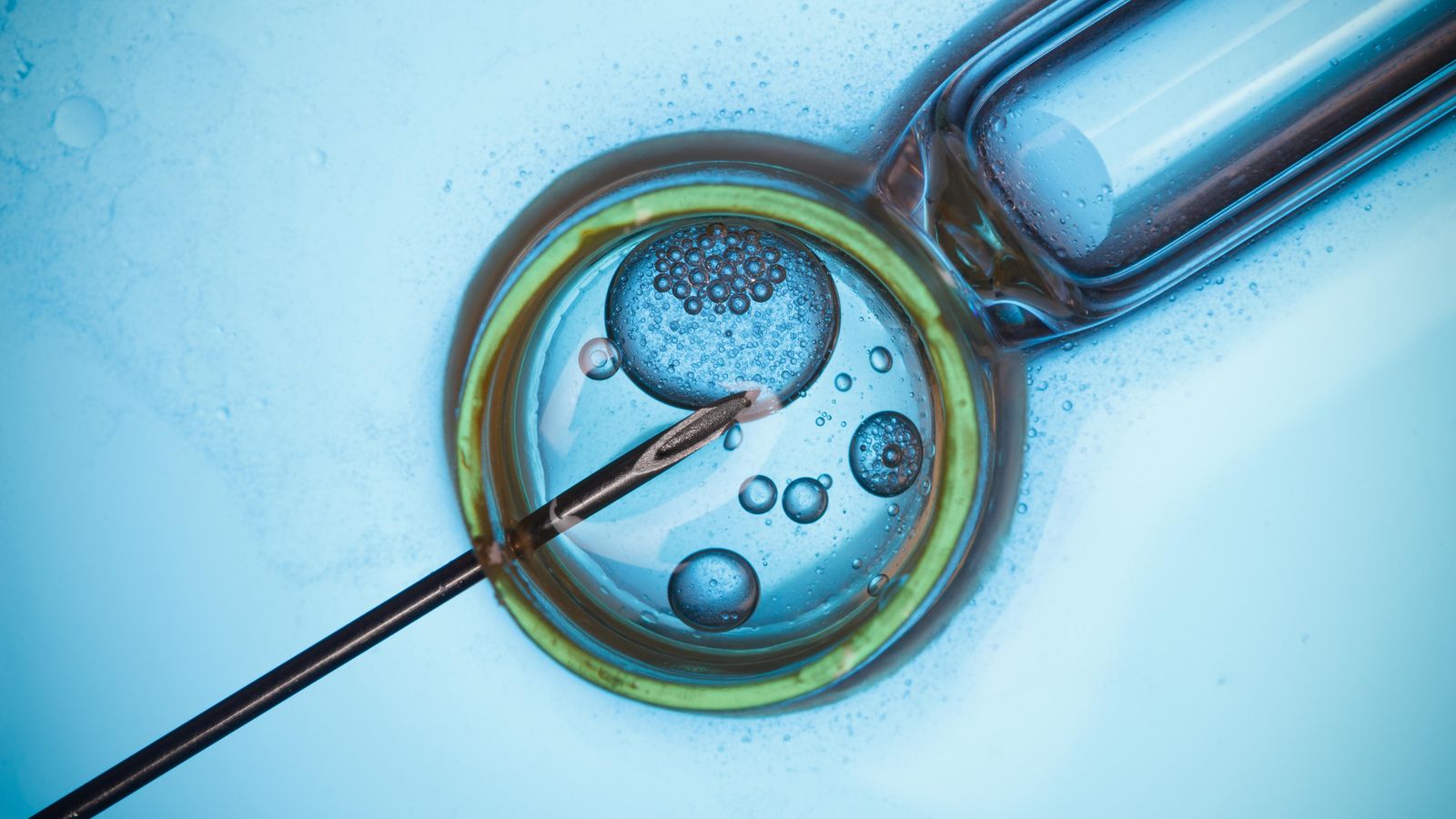 Imatge d'arxiu de fertilització in vitro