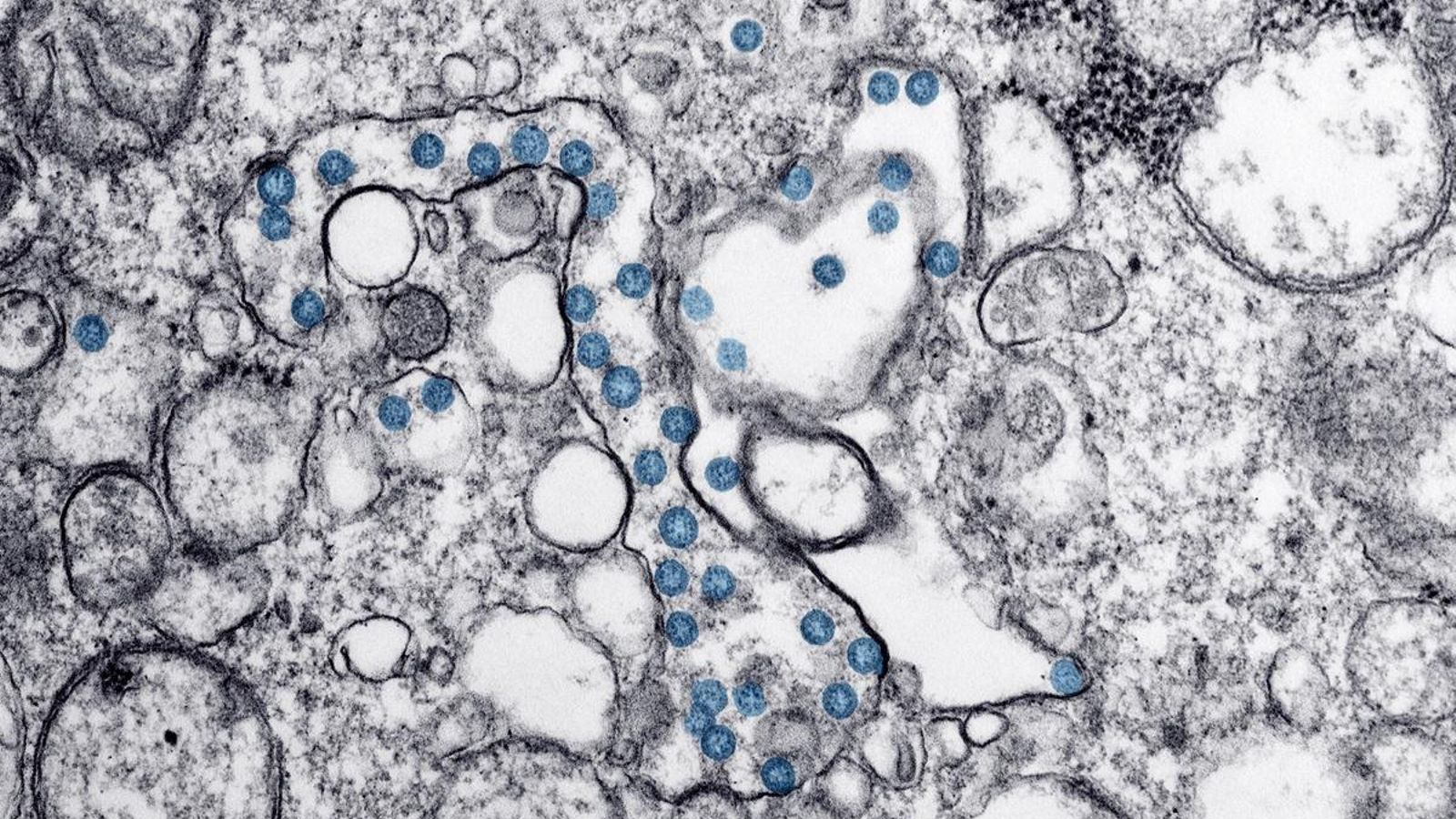 Partícules del virus SARS-CoV-2, acolorides en blau, en una imatge de microscopi d'electrons