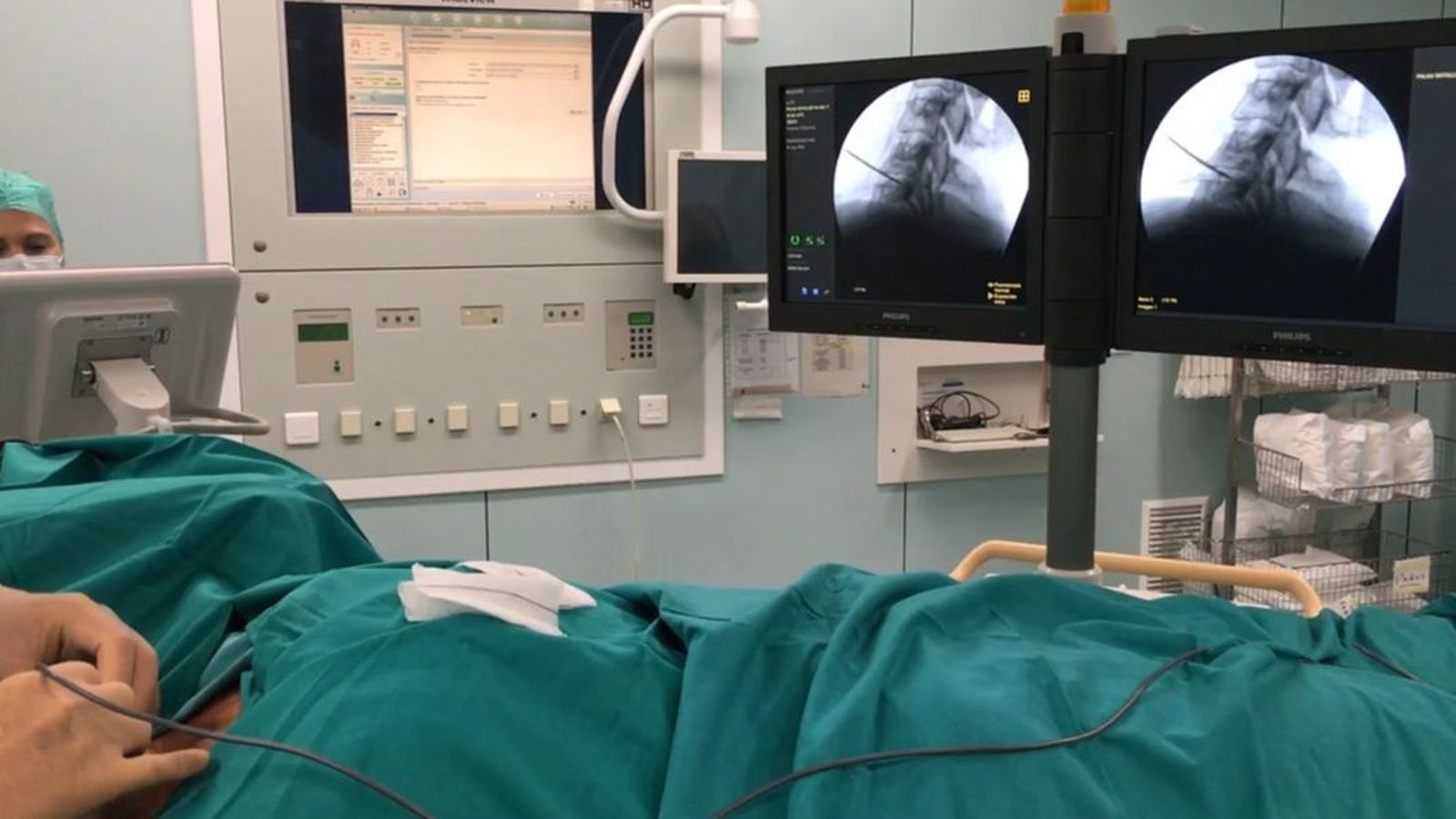 La unitat de dolor de l'Hospital La Fe utilitza una tècnica pionera a l'estat per a tratar el dolor cervical