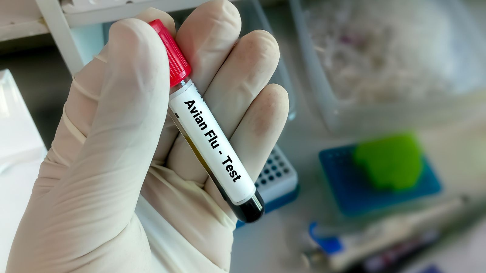 Test per a detectar grip aviària