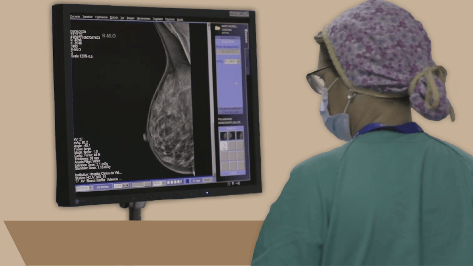 Mamografia d'una pacient a l'Hospital Clínic de València