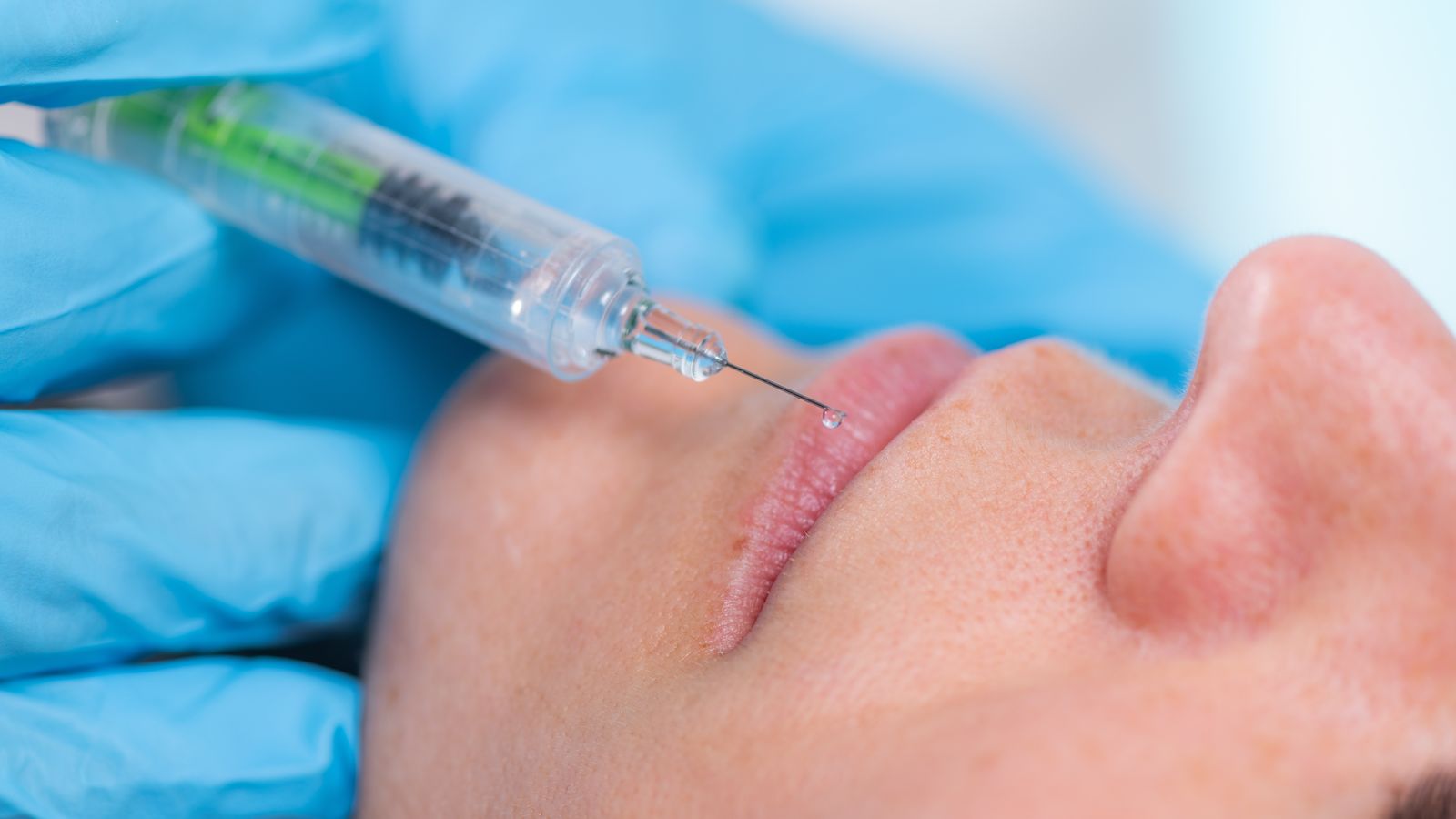 Una injecció d'àcid hialurònic en una imatge d'arxiu