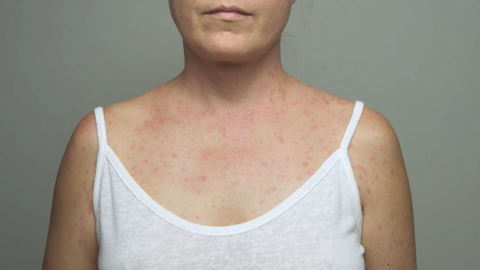 Una dona amb pallola