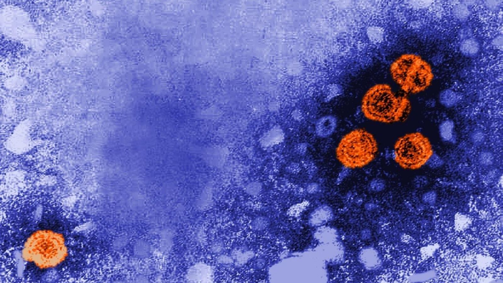 Imatge microscòpica electrònica transmision acolorida digitalment revela la presència de virions de l'hepatitis B Imatge microscòpica electrònica transmision acolorida digitalment revela la presència de virions de l'hepatitis B
