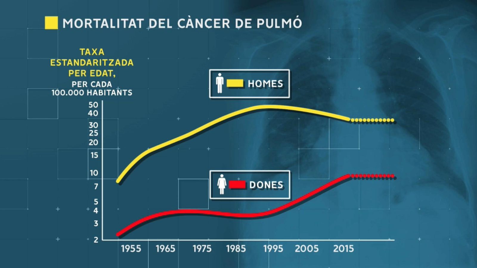 La mortalitat del càncer de pulmó en dones creix des del 1995