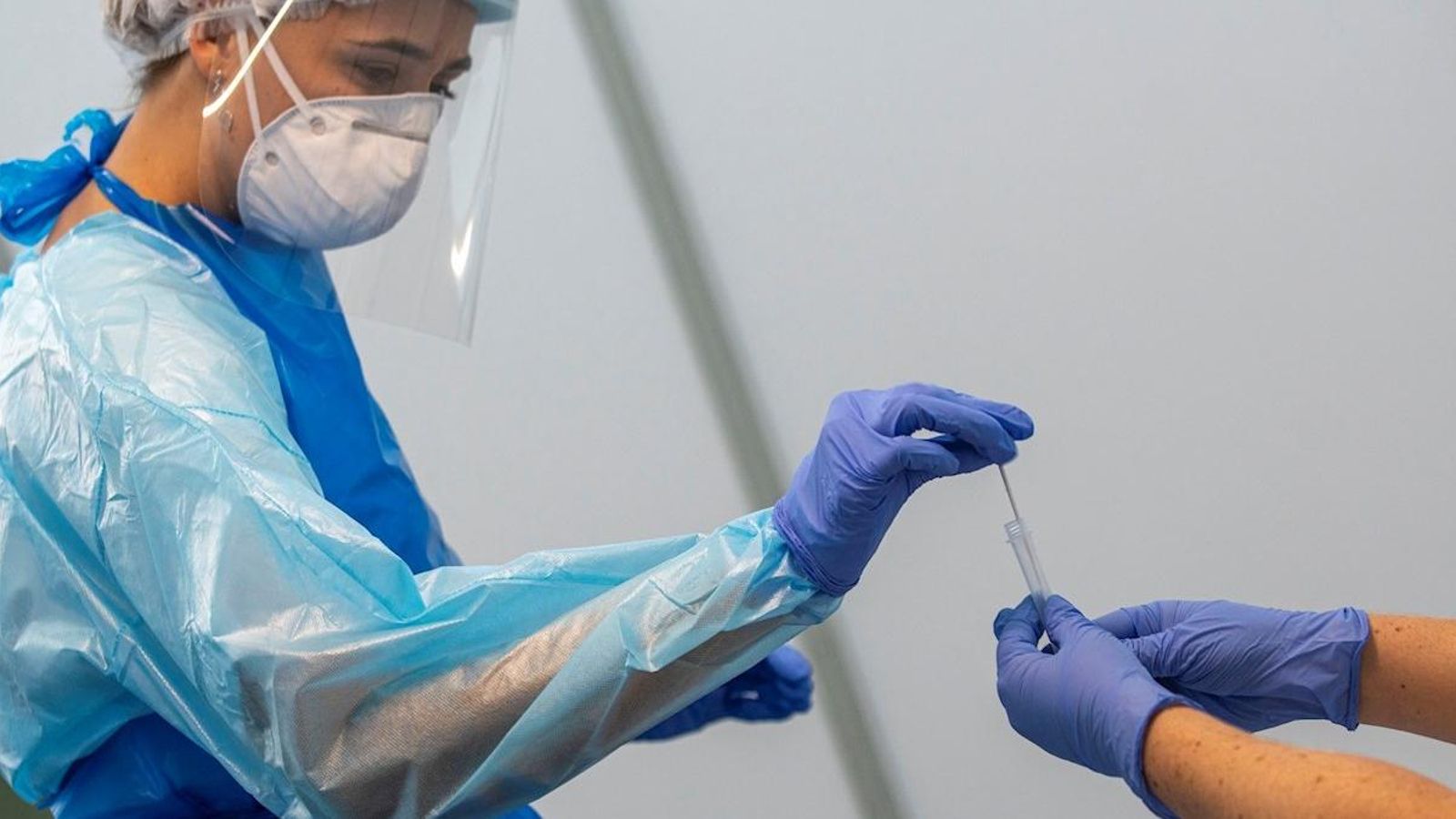 Proves PCR en una imatge d'arxiu