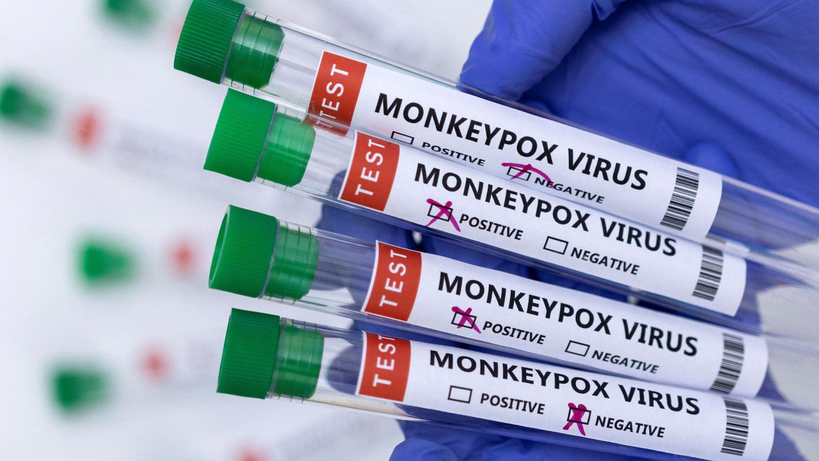 Mostres analítiques del virus de la pigota dels micos ('monkeypox' en anglés)