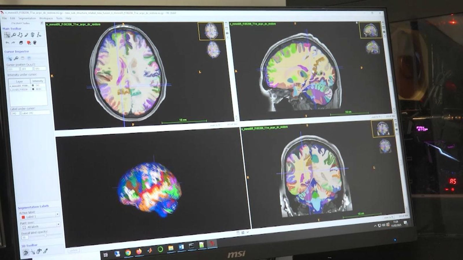 Imatges del cerebel obtingudes mitjançant el programari DeepCeres