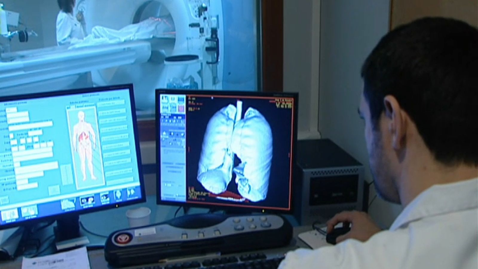 Augmenta la supervivència al càncer en els cinc anys posteriors al diagnòstic