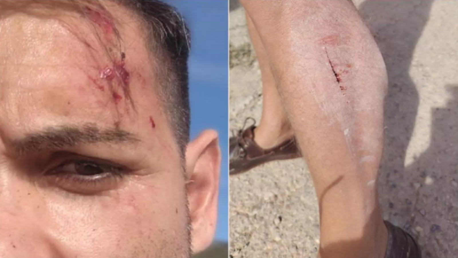 Un equip d'À Punt, brutalment agredit per dos ramaders a Alcalà de Xivert