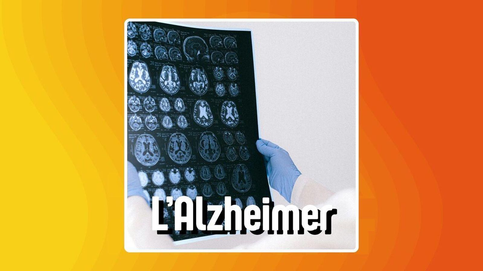 18.09.2025 | l’Alzheimer, una malaltia que afecta prop de 800.000 persones a Espanya