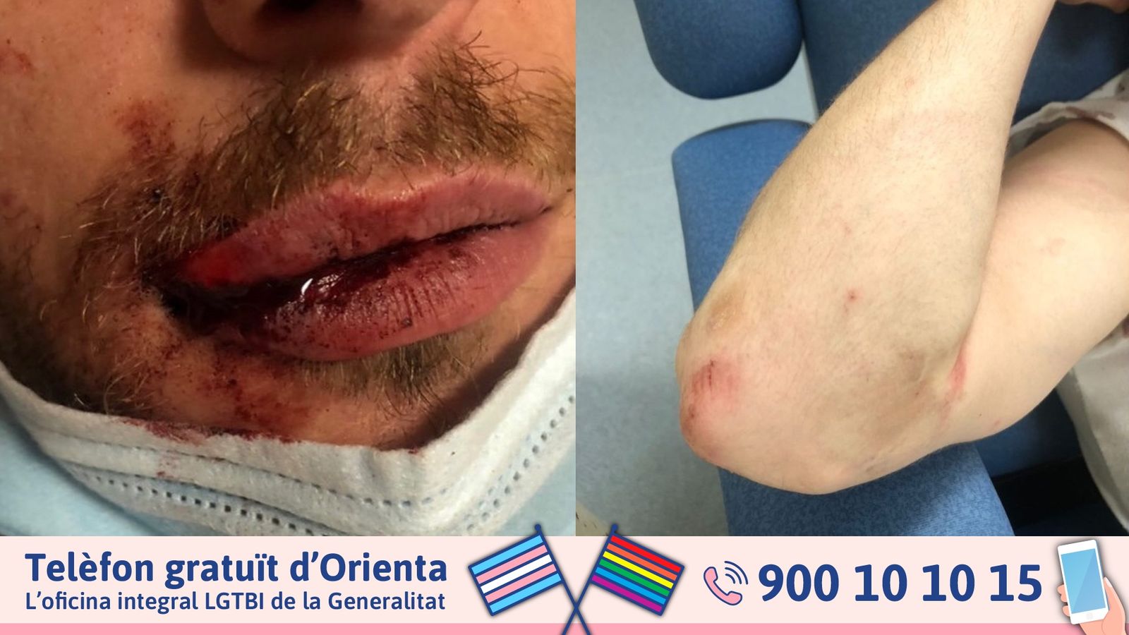 Fotos de la víctima després de les agressions