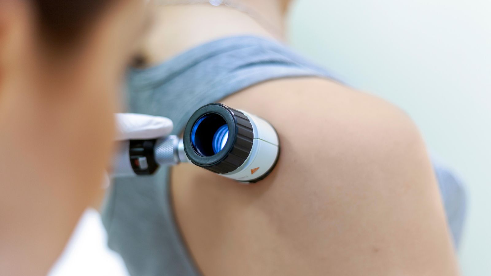 Una dermatòlga examina la pell d'una pacient Una dermatòlga examina la pell d'una pacient