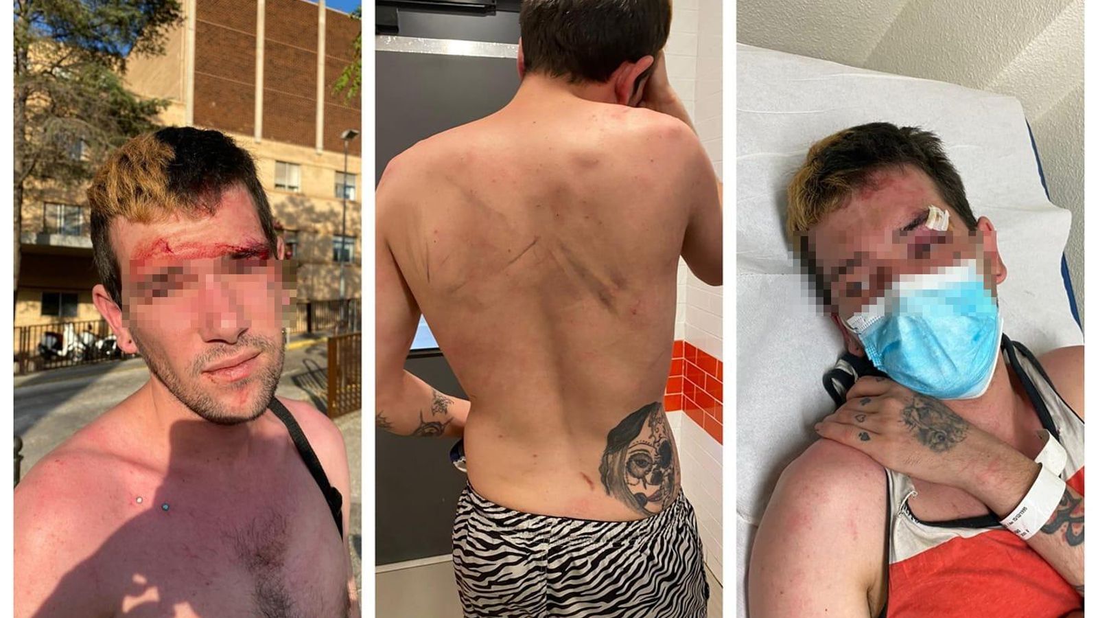 Imatges de les agressions patides pel jove