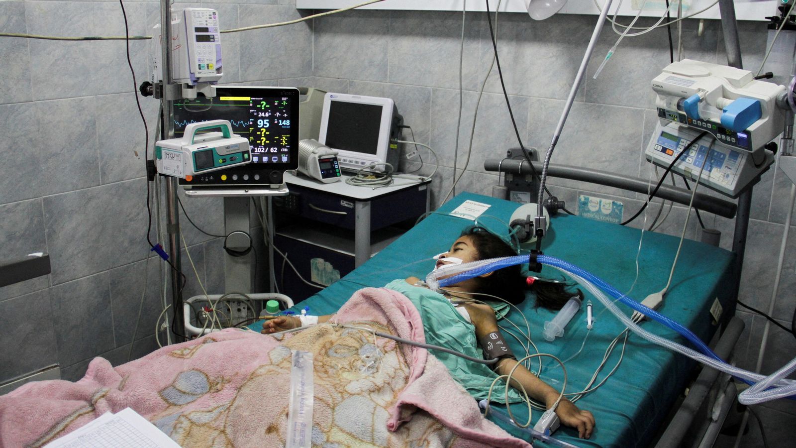 Una xiquet palestina rep assistència per malnutrició a l'hospital Kawal Adwan, un dels pocs recursos sanitaris operatius al nord de la Franja de Gaza Una xiquet palestina rep assistència per malnutrició a l'hospital Kawal Adwan, un dels pocs recursos sanitaris operatius al nor de la Franja de Gaza