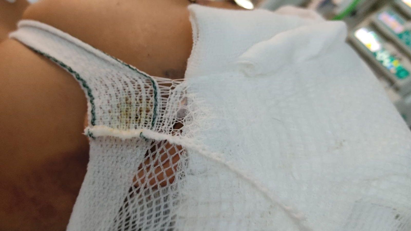 Imatge del menor ingressat a l'hospital La Fe de València