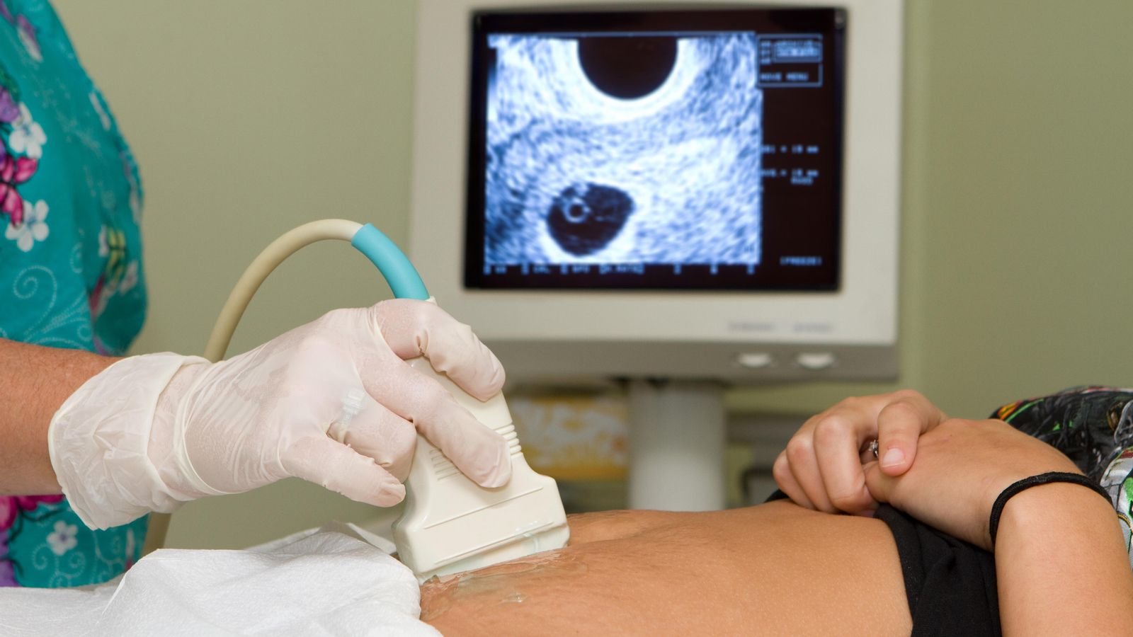 Una tècnica sosté un transductor d'ultrasò per a diagnosticar l'estat d'una dona embarassada
