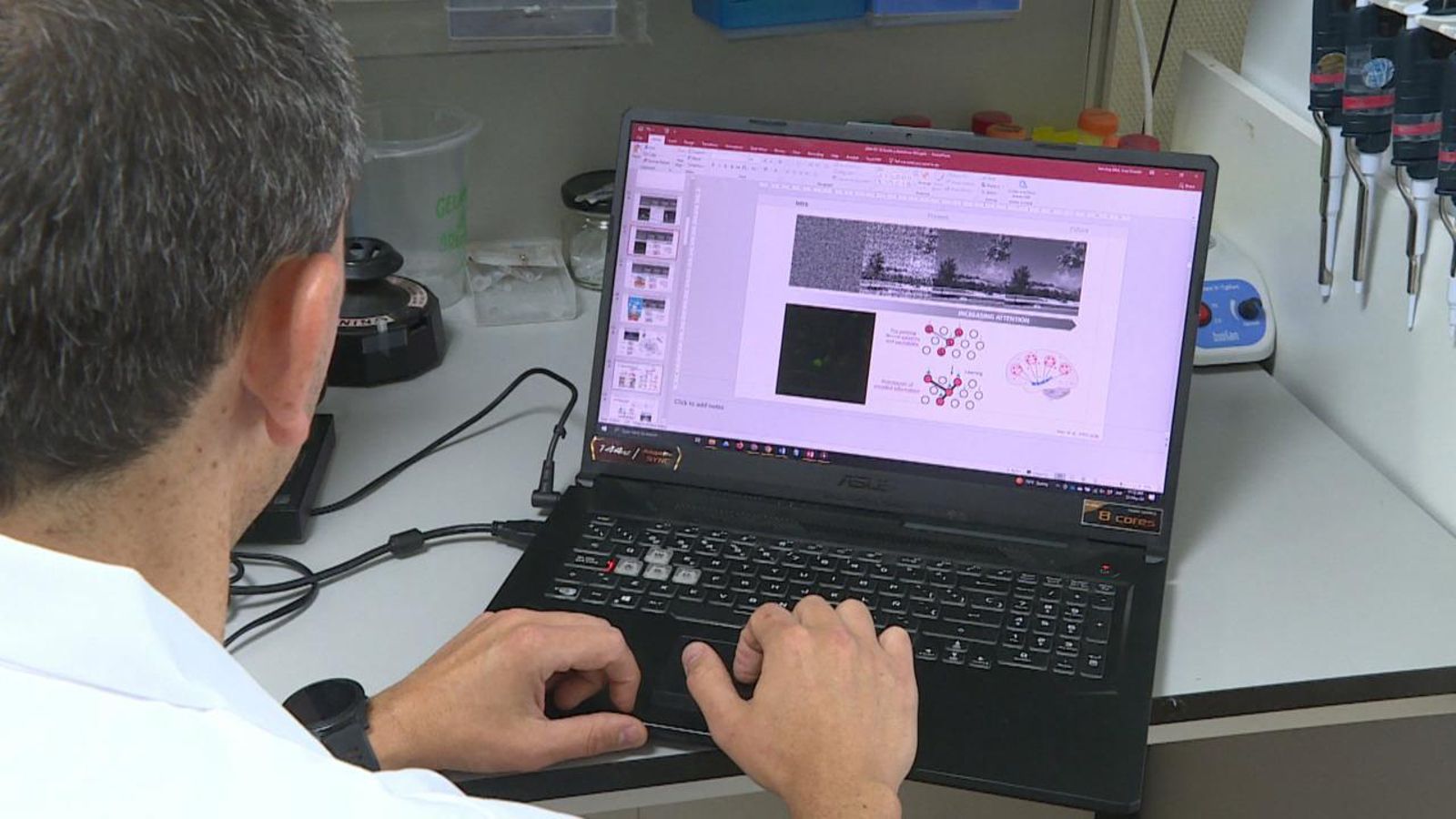 Descansar de manera adequada, clau per previndre l'Alzheimer