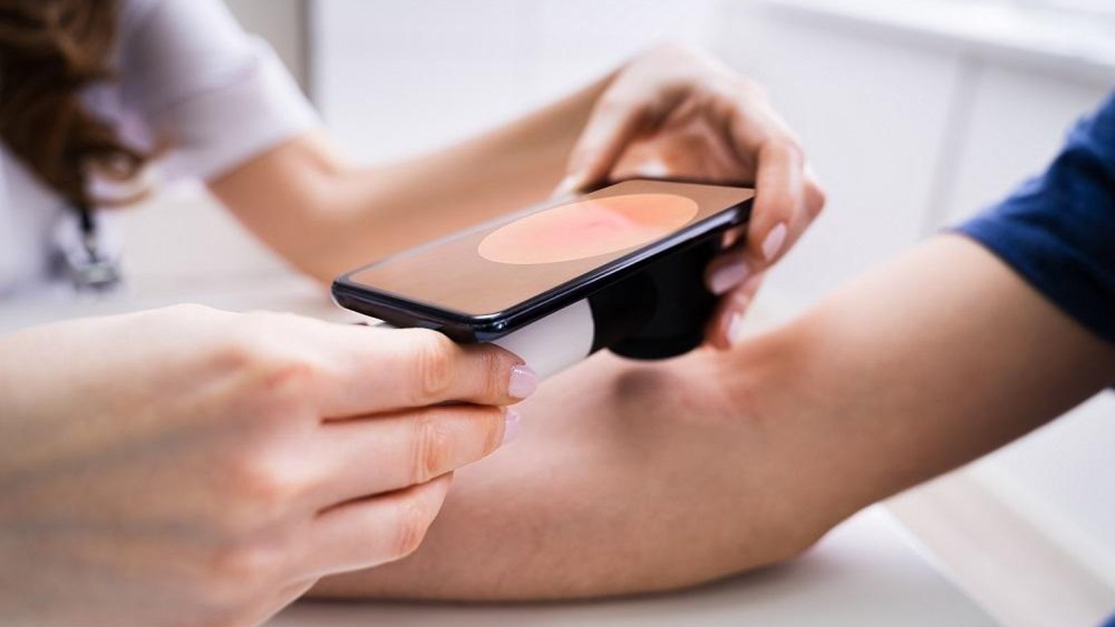 Un dermatòleg revisant la pell d'un pacient