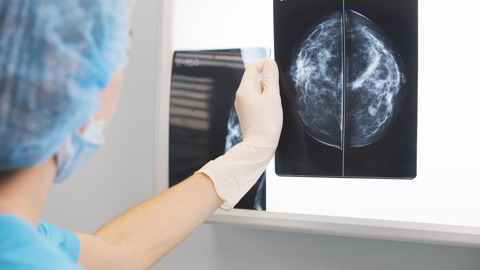 Una doctora analitza una mamografia