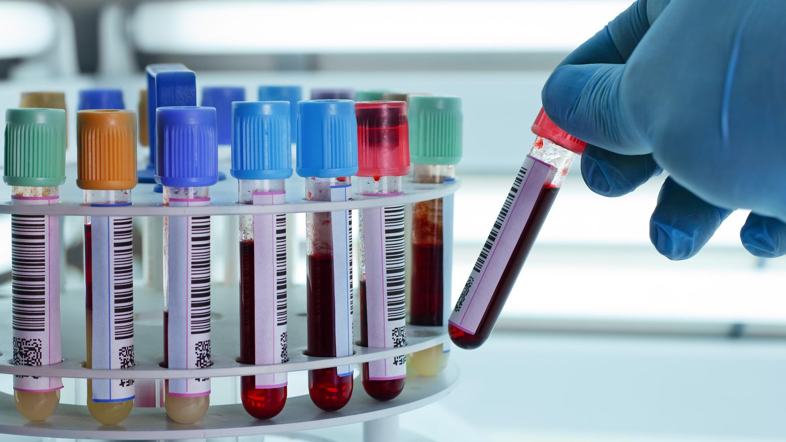 Mostres de sang en un laboratori