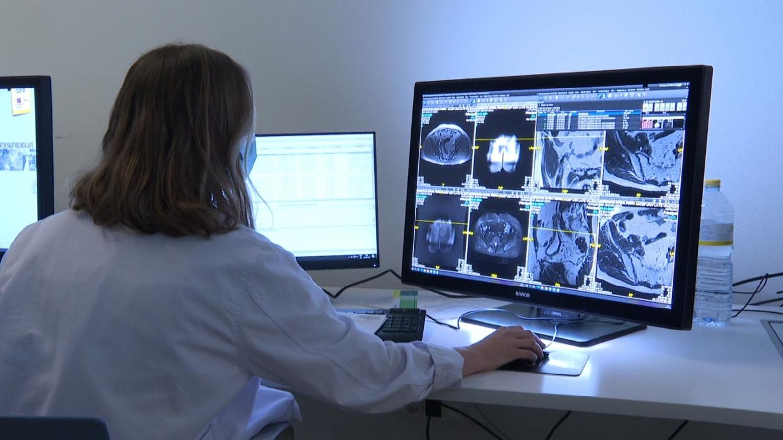 El major banc d'imatges mèdiques que s'ha fet mai a la Unió Europea està dirigit des de València