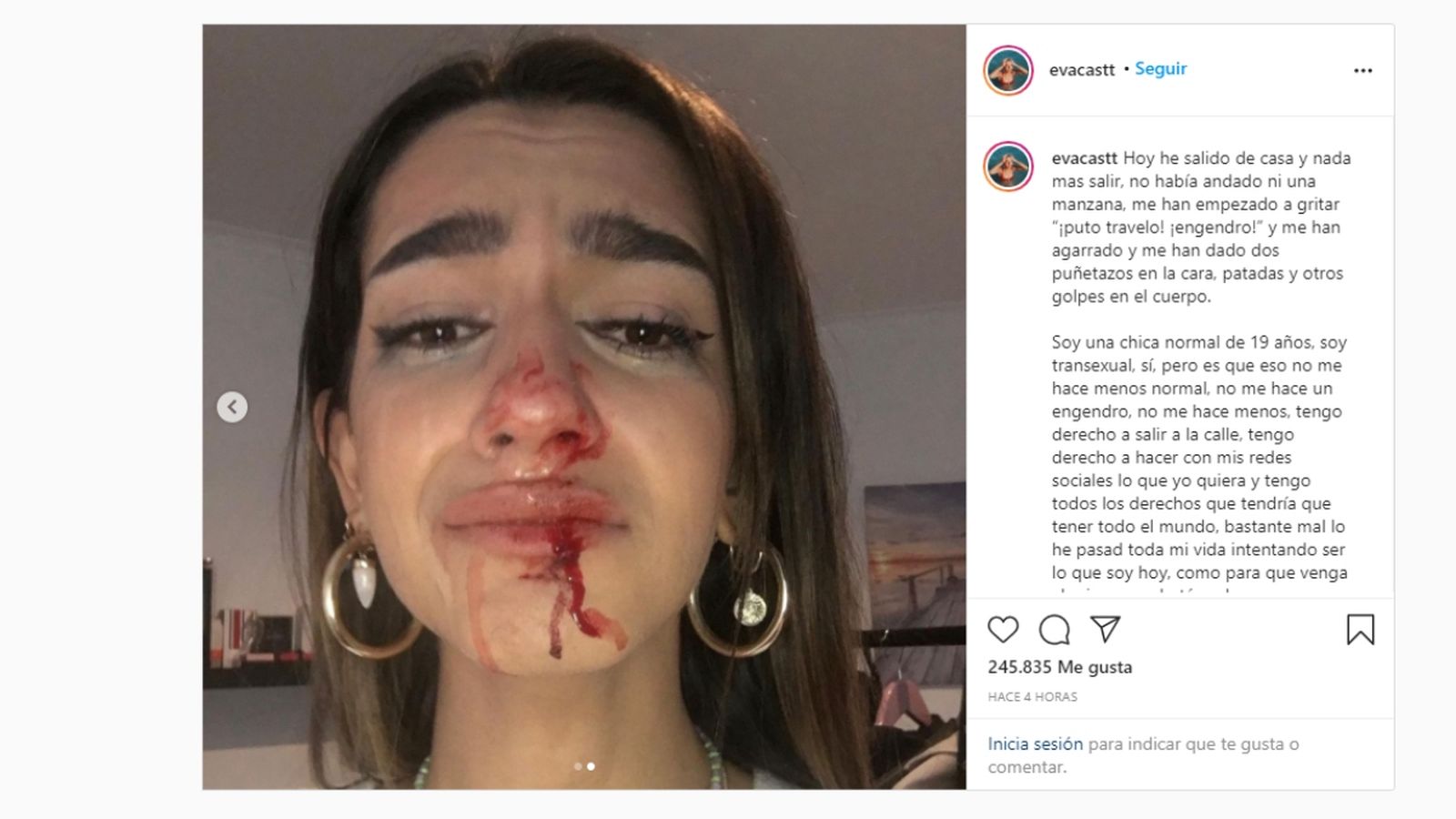 Fotografia publicada per Eva Vildosola per a denunciar l'agressió