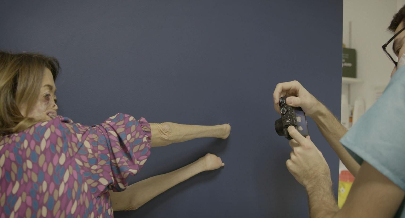 Fide li mostra a l'especialista com la malaltia li ha 'menjat' el rostre i les mans