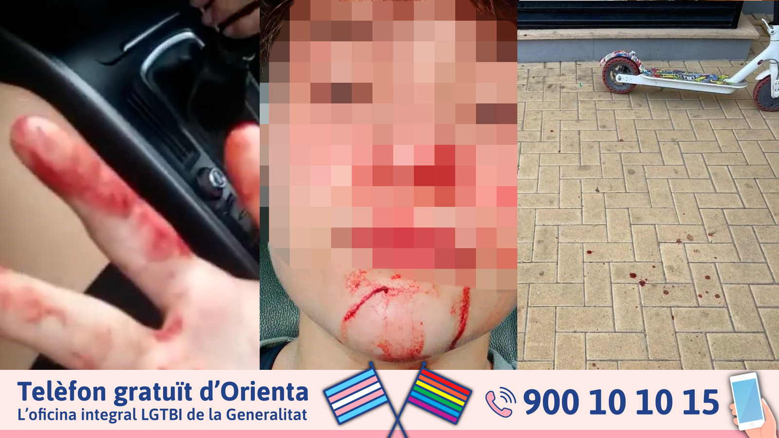 Una xiqueta pateix una agressió homòfoba