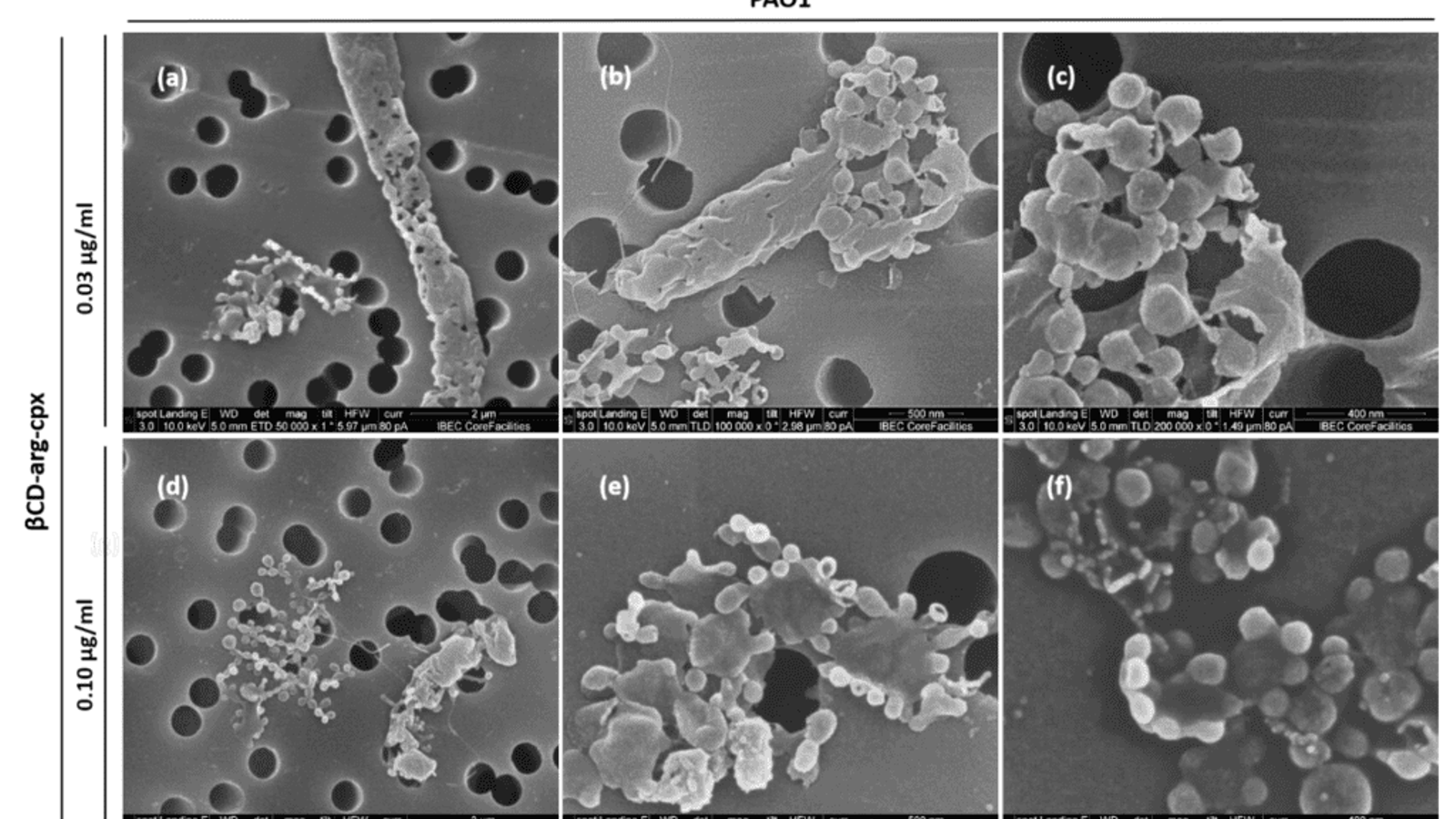 Descomposición de la membrana en una estructura similar a una vesícula en Pseudomonas aeruginosa tratada con ciprofloxacina