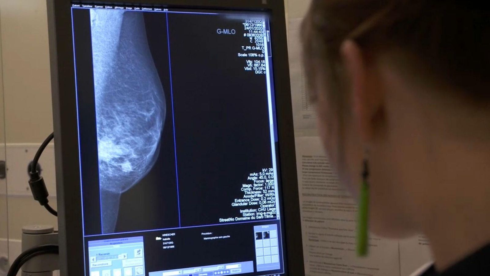 Una sanitària observa una mamografia, en una imatge d'arxiu