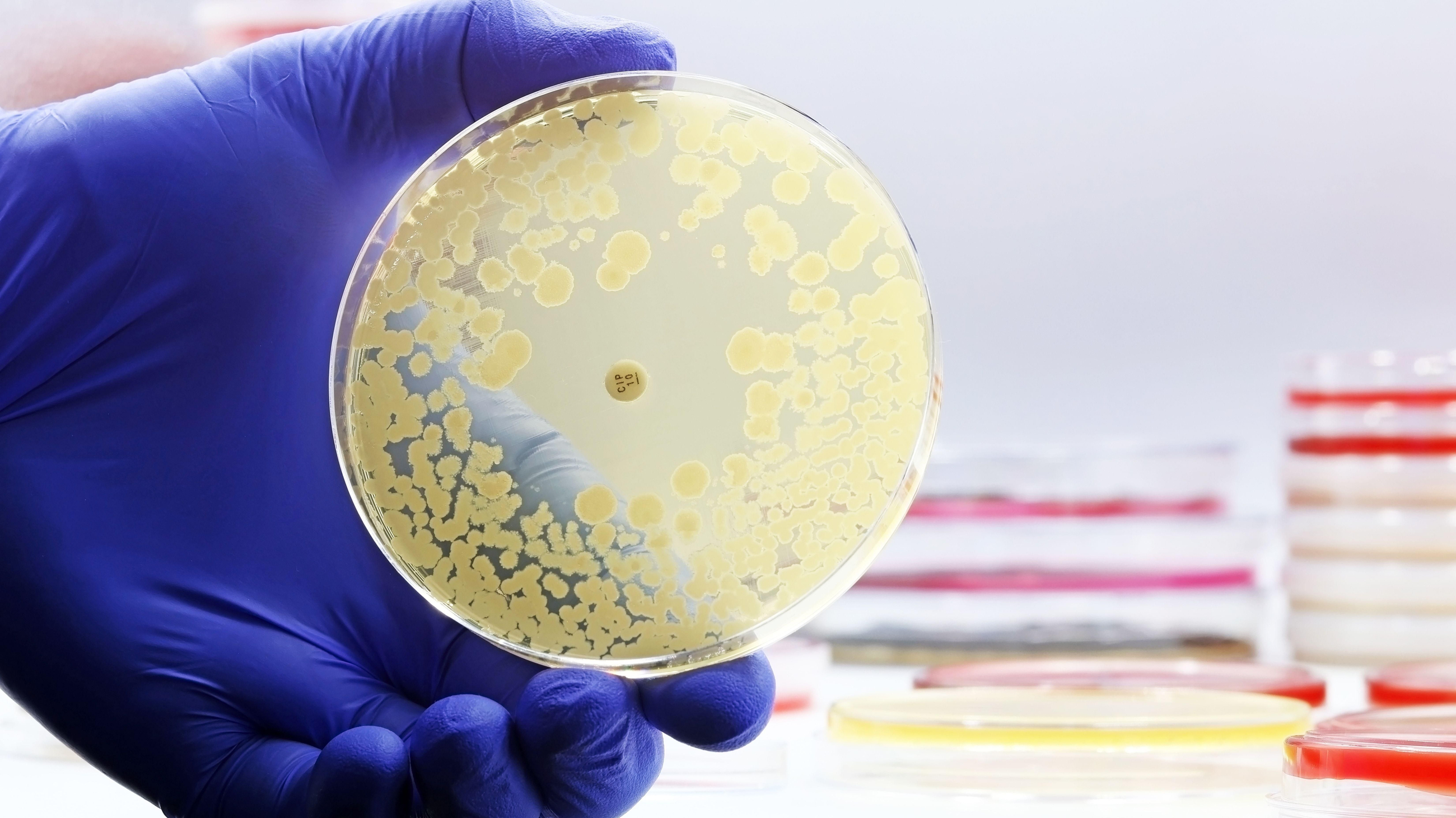 Cultiu microbiològic en una placa de Petri (arxiu) Cultiu microbiològic en una placa de Petri (arxiu)