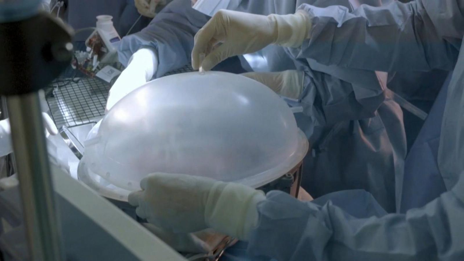 Imatge del fetus d'ovella introduït a la placenta artificial