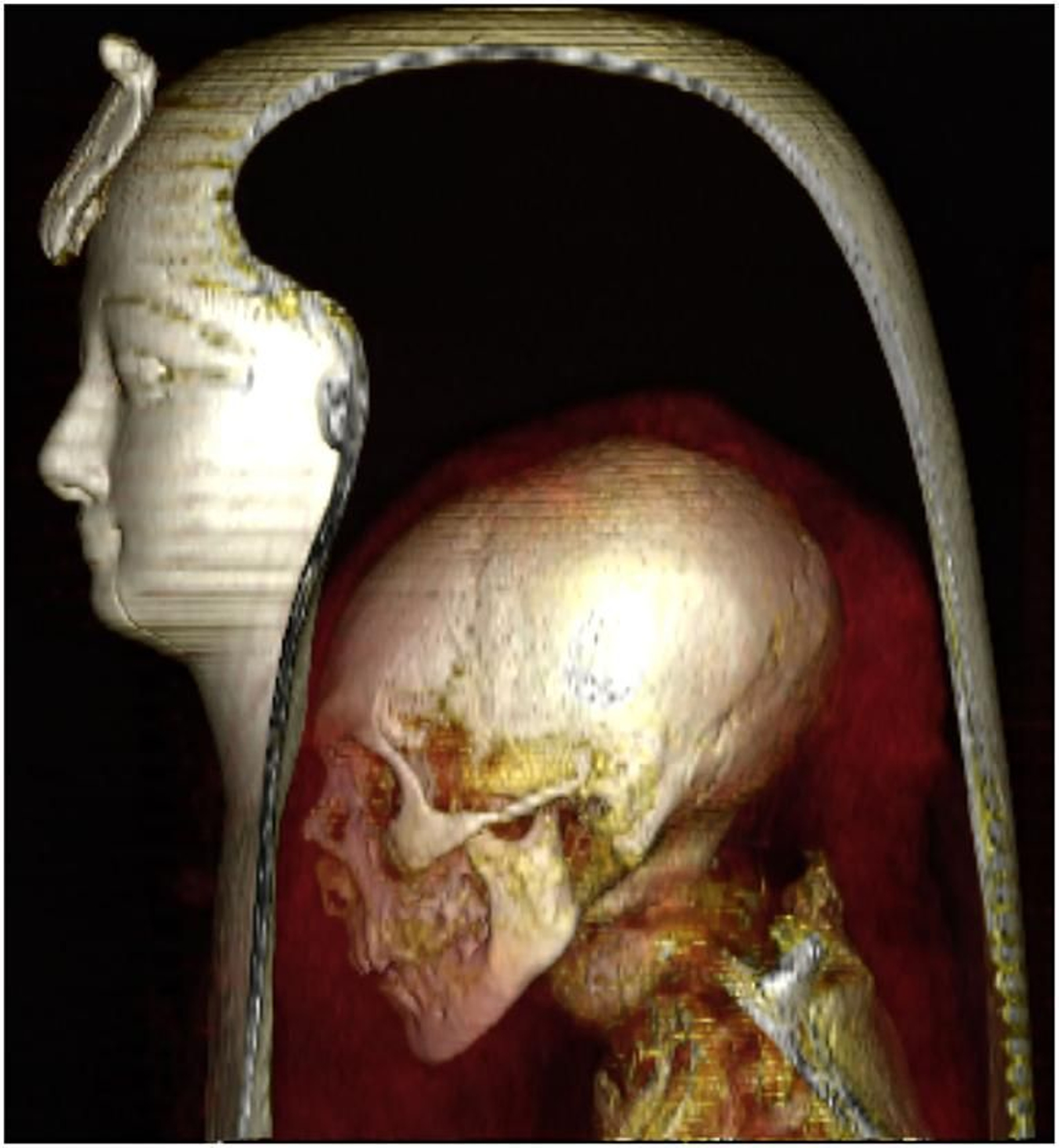 Escàner per tomografia computada de la calavera i el coll d'Amenhotep I