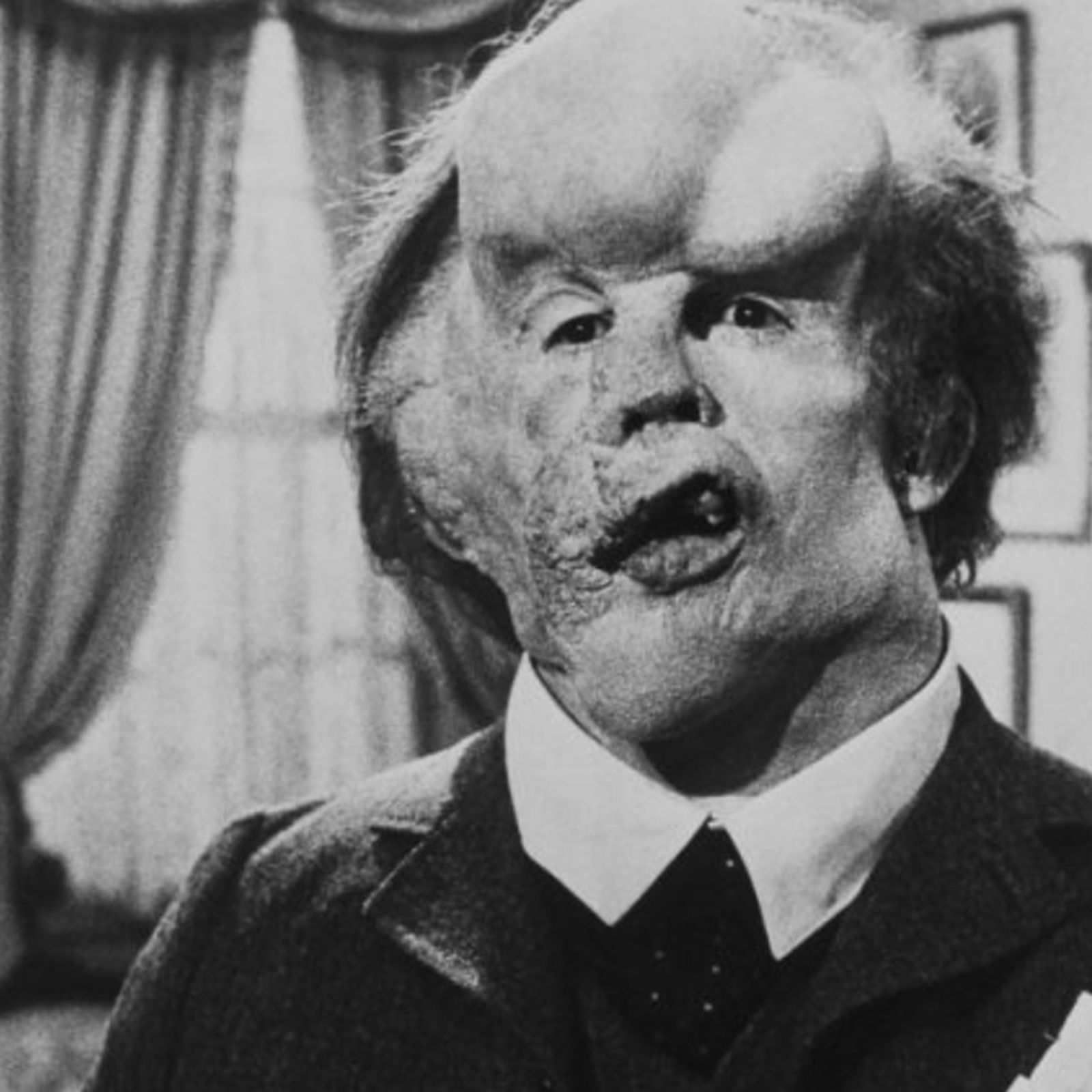 31.07.2019 | Joseph Merrick, 'l’Home Elefant'