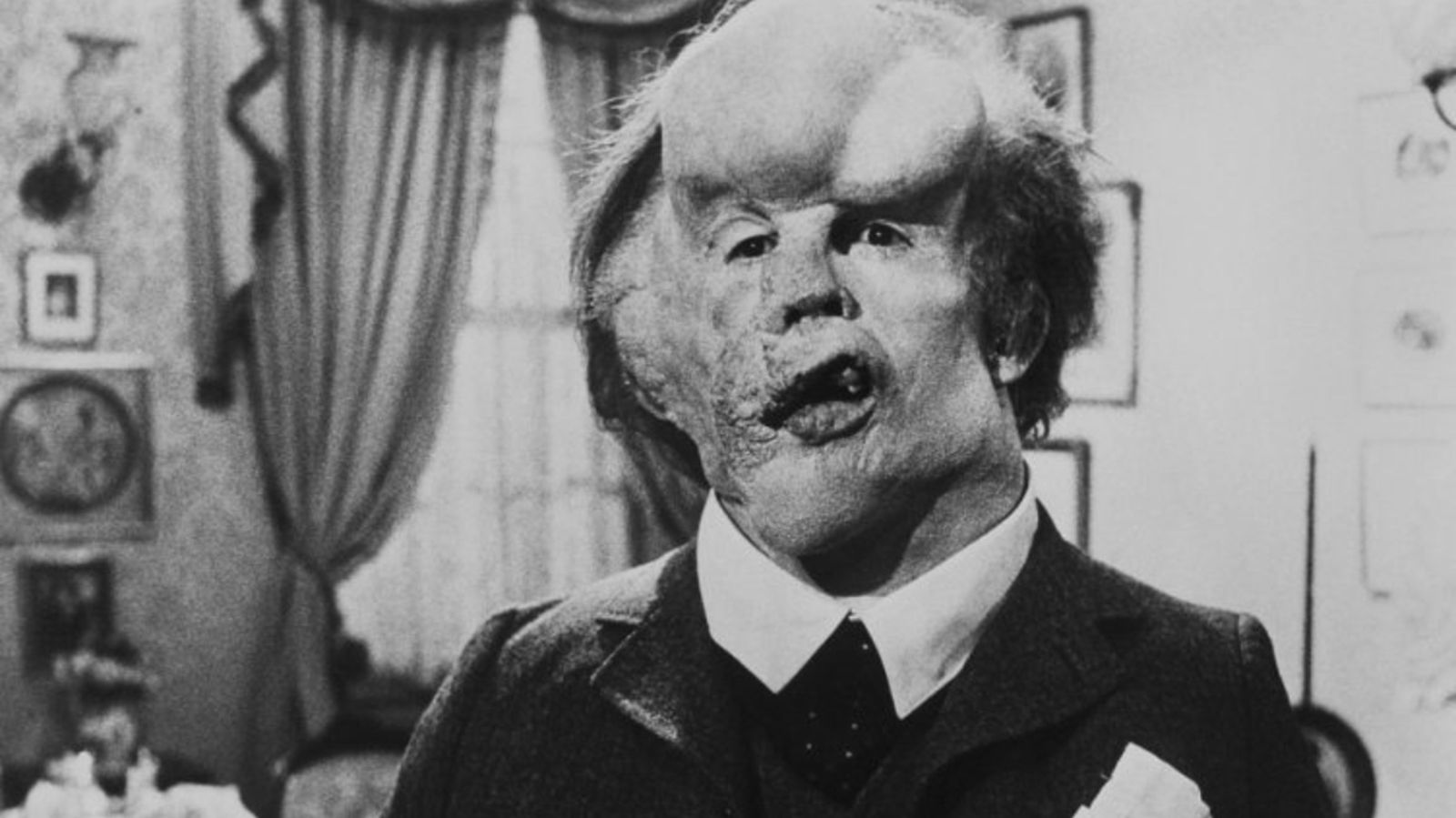 31.07.2019 | Joseph Merrick, \'l’Home Elefant\'