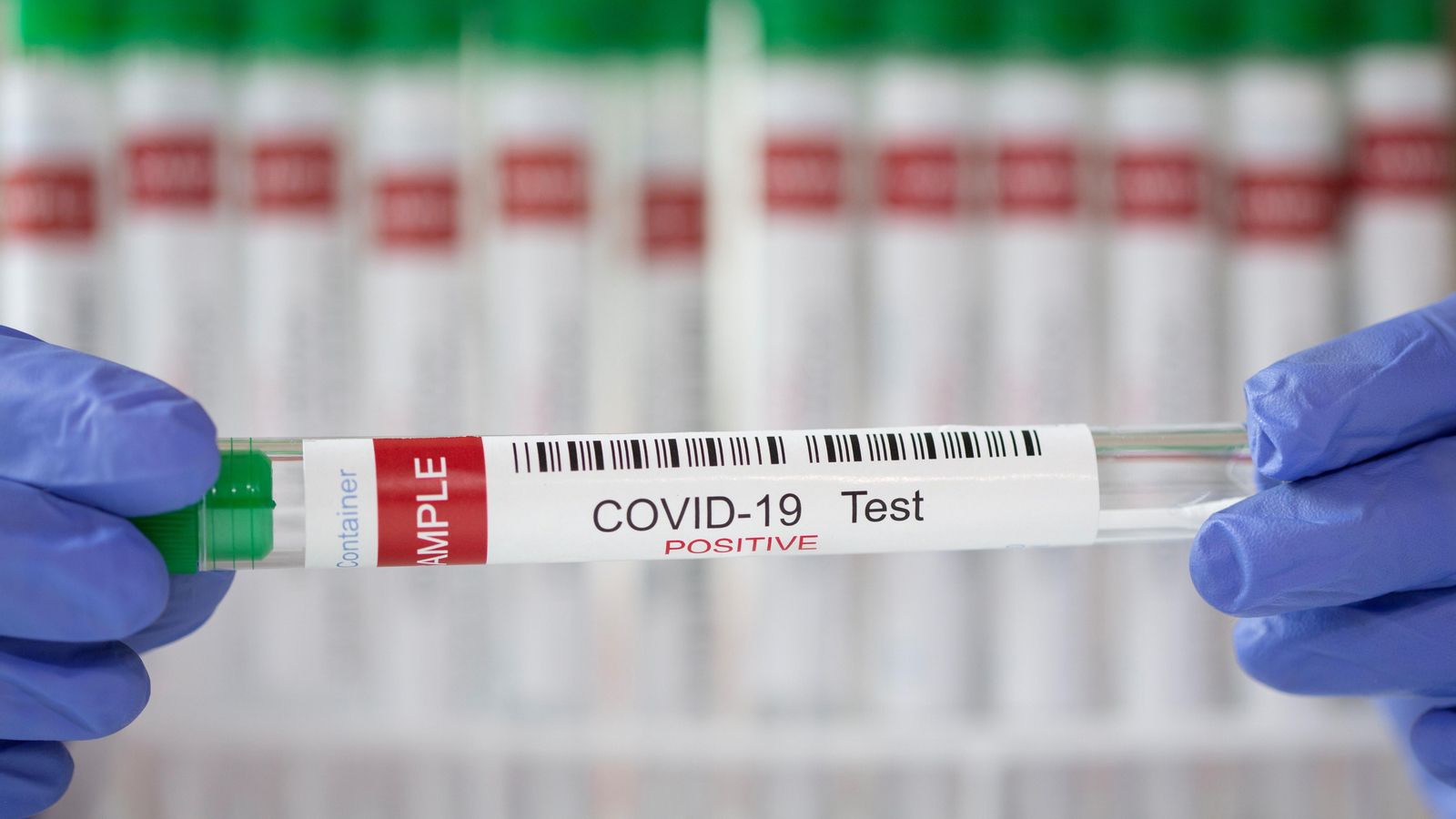 Tub de laboratori amb mostra positiva per coronavirus
