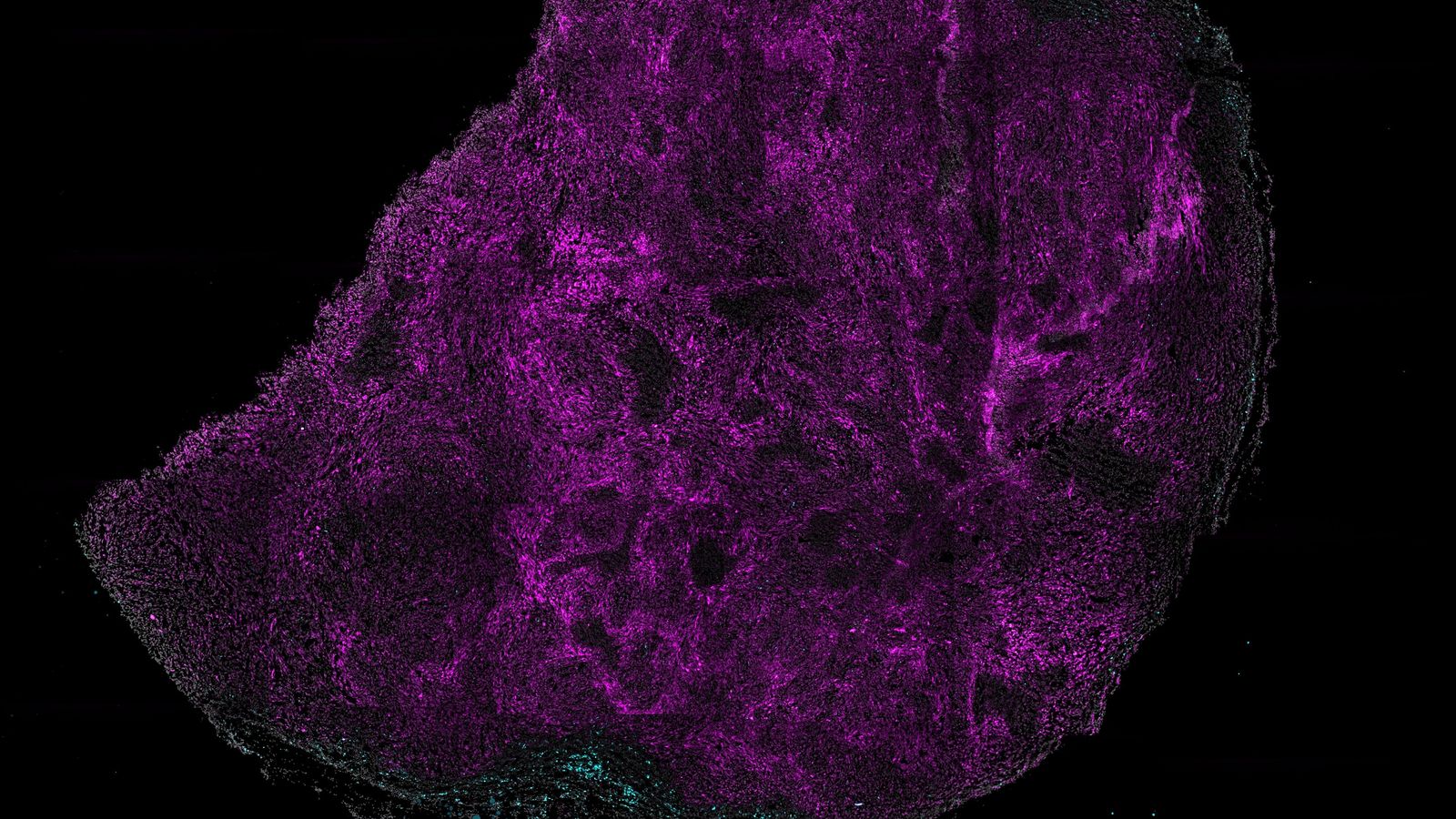 La investigadora Pilar *Baldominos desenvolupa un estudi sobre els mecanismes de defensa que presenten algunes cèl·lules tumorals per a sobreviure al sistema immune