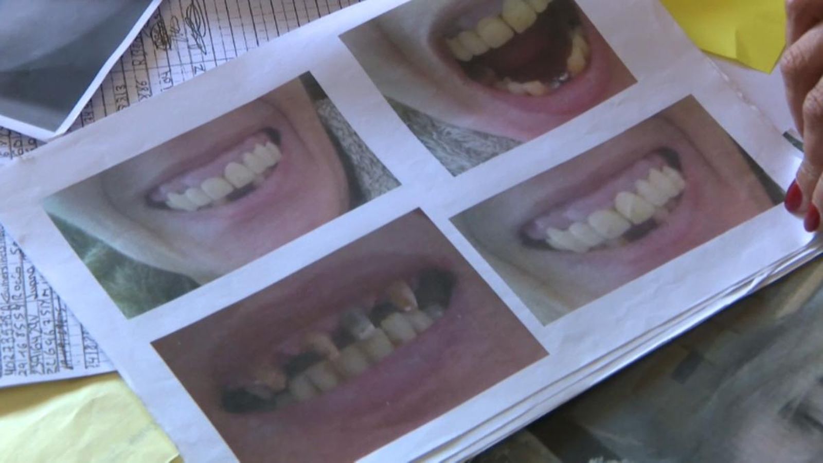 La Conselleria investiga iDental des del 2017