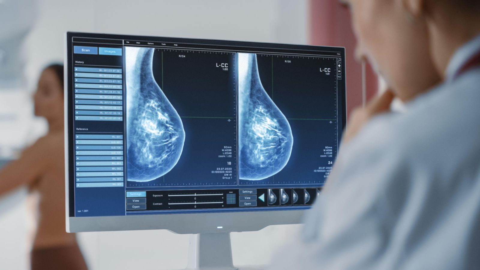 Una pacient se sotmet a una mamografia (arxiu)