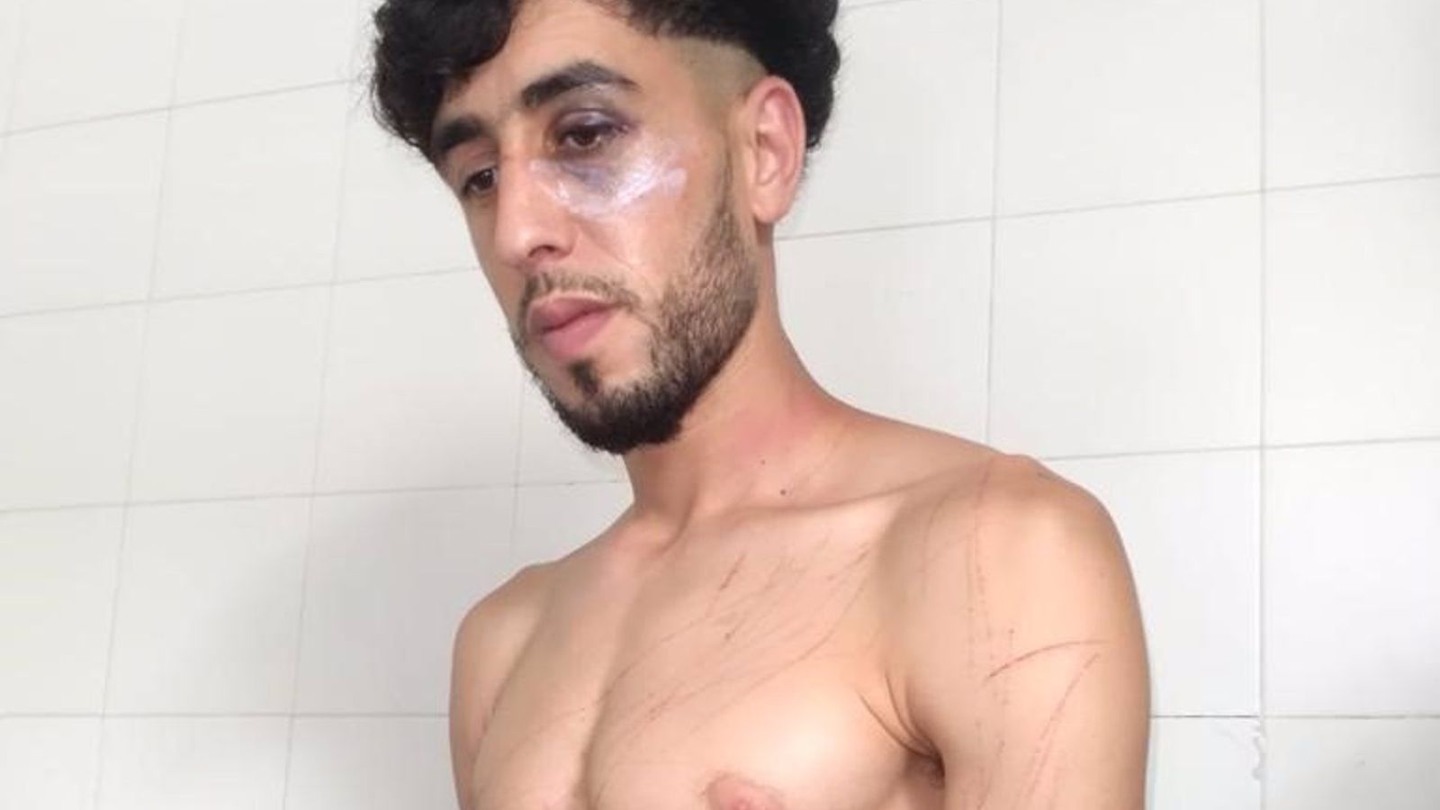 Intern del CIES de Sapadors presumptament agredit