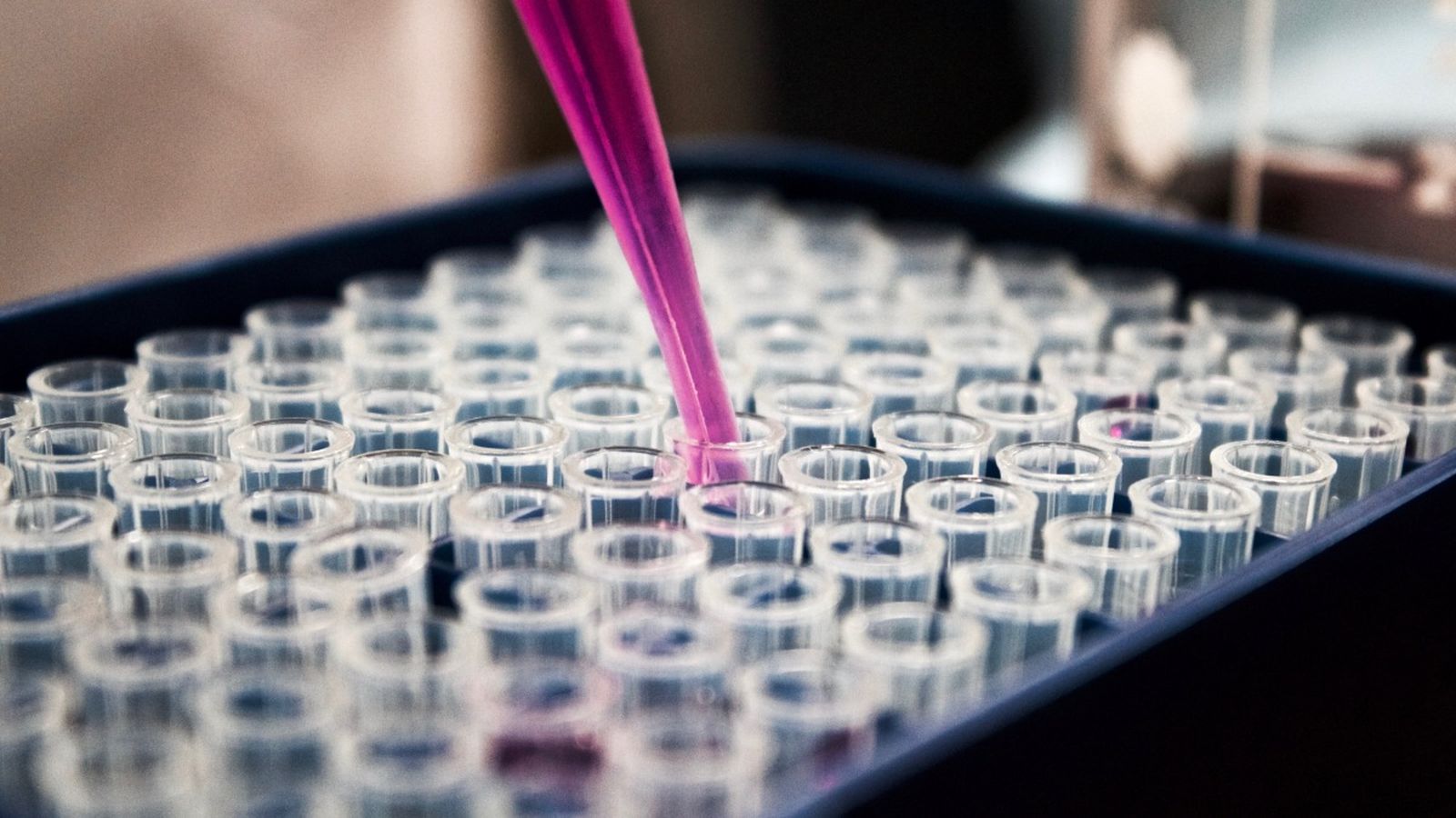 La dona va patir una reacció anafilàctica greu després de practicar sexe oral sense protecció amb el marit