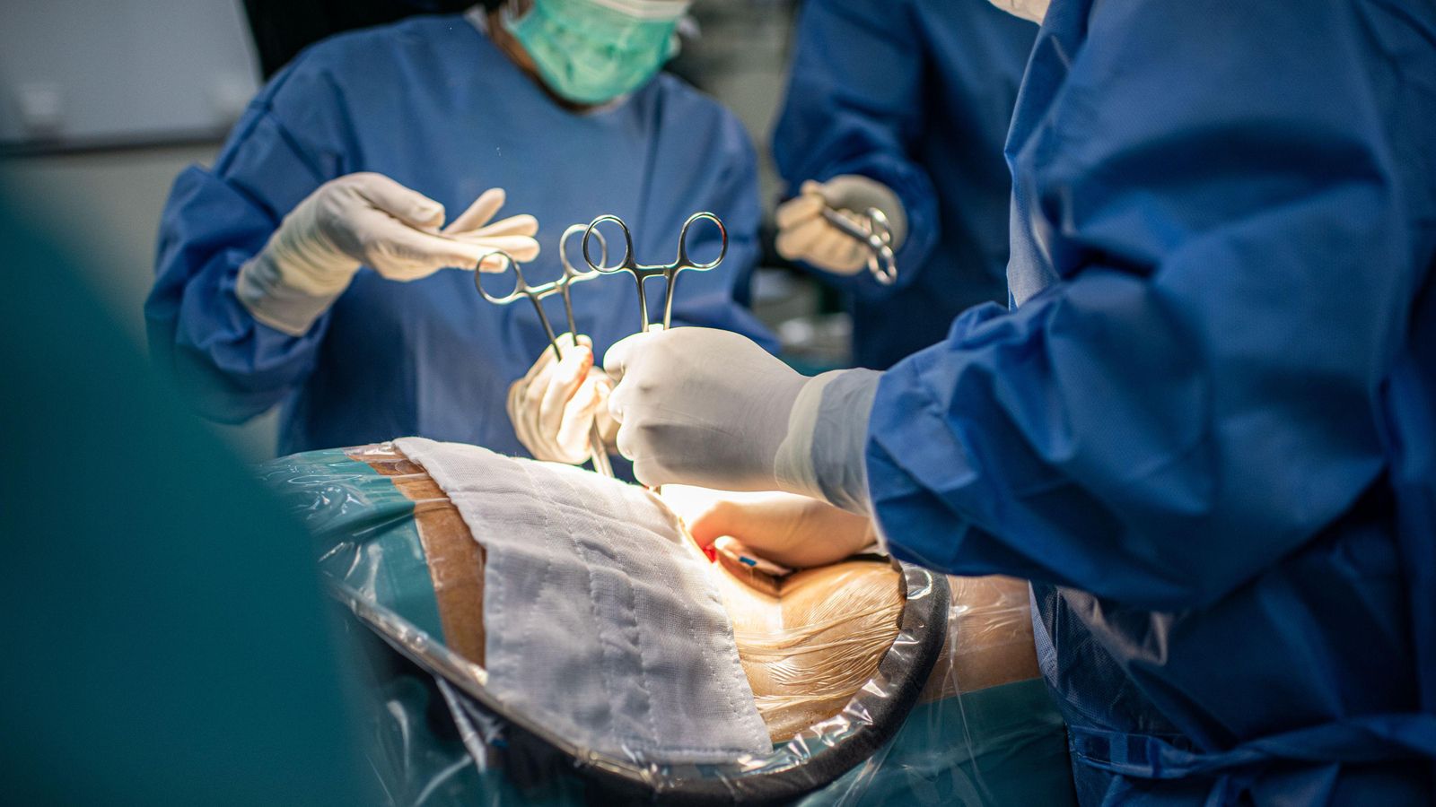 Imatge d'arxiu d'un part amb cesària