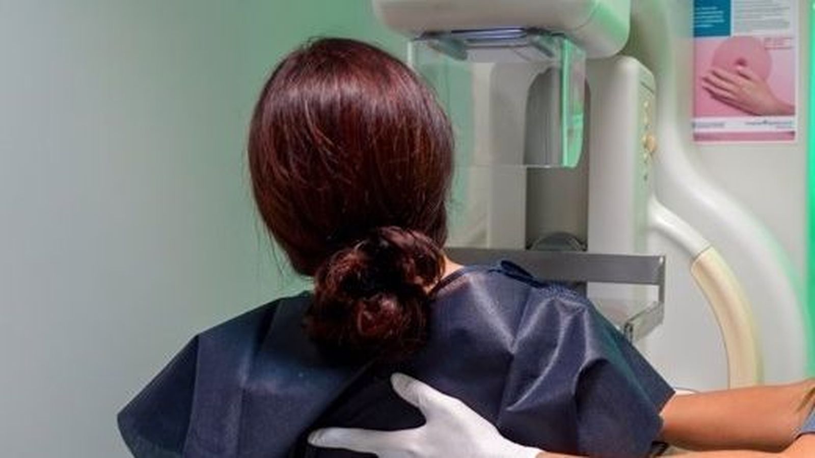 Imatge de recurs de mamografia