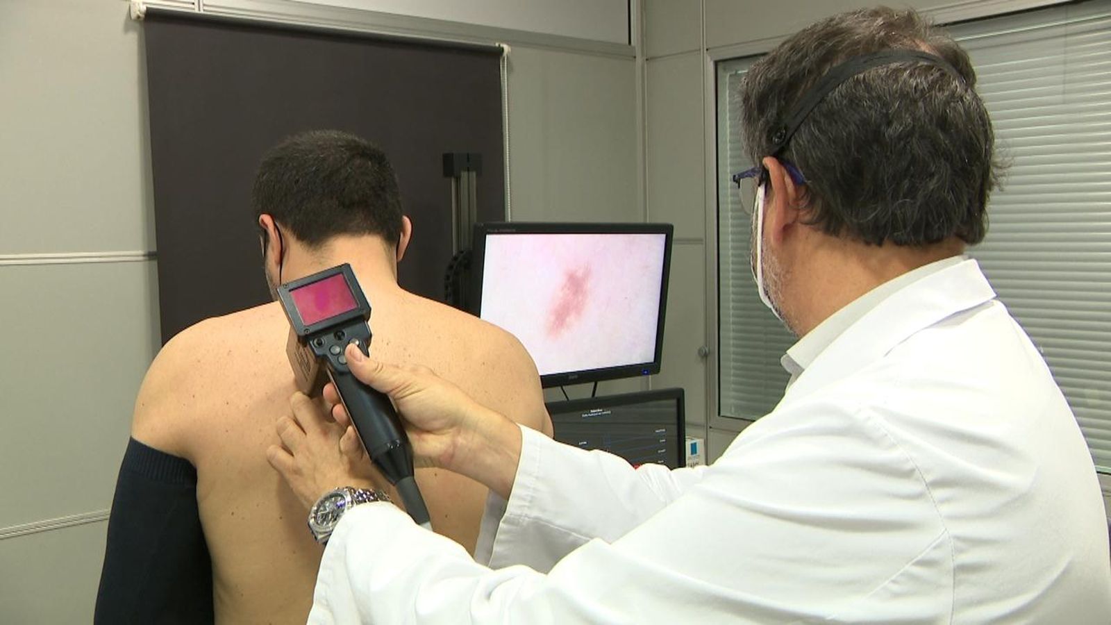 La incidència del melanoma a la Comunitat és una de les més altes amb una mitjana de 12,4 casos caa 100.000 habitants.