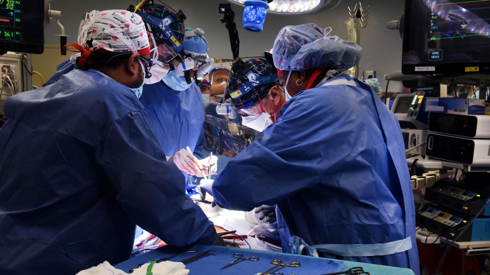L'equip mèdic que ha dur a terme el trasplantament, durant la intervenció